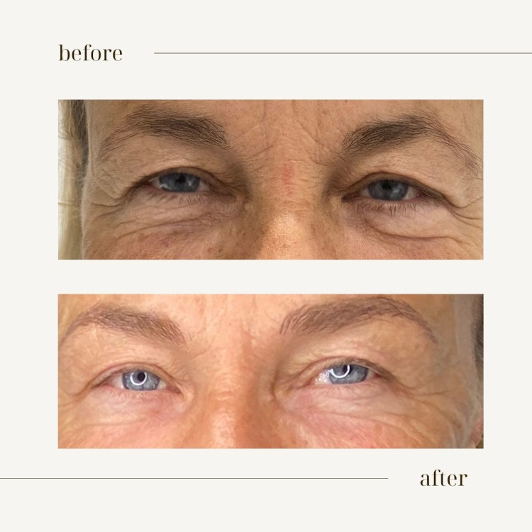 maquillage permanent colombe